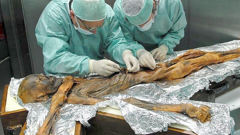Wissenschaftler untersuchen in Bozen die rund 5000 Jahre alte Gletschermumie „Ötzi“ und entnehmen Proben des Mageninhaltes. Foto: M.Samadelli/Southtyrolarchaeologymuseum\Eurac via Eurekalert/dpa