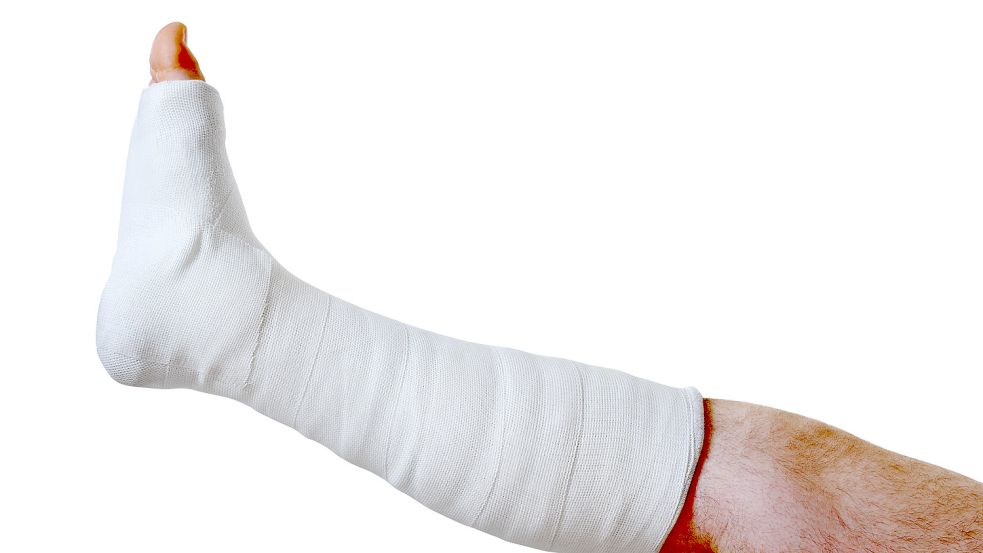 Ein Fuß in Gips ist kein Spaß. Wenn es bis zur Behandlung des Bruchs Stunden dauert, ist das für den Patienten sehr ärgerlich und unter Umständen schmerzhaft. Foto: Adobe Stock/chaoss