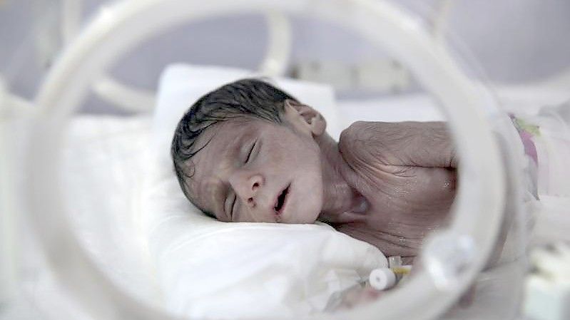 Ein unterernährtes Neugeborenes liegt in einem Krankenhaus in Sanaa. Foto: Hani Al-Ansi/dpa