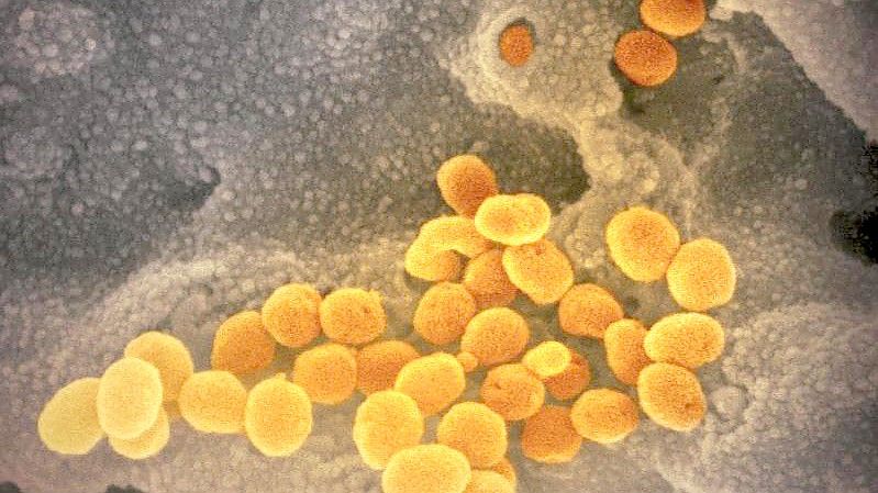 Eine elektronenmikroskopische Aufnahme zeigt das neuartige Coronavirus, das aus der Oberfläche von im Labor kultivierten Zellen austritt. Foto: NIAID-RML/AP/dpa