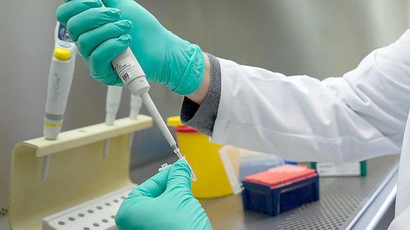 Ein Forscher zeigt, wie ein PCR-Test für die Analyse auf Mutationen des Coronavirus vorbereitet wird. Foto: Sebastian Gollnow/dpa
