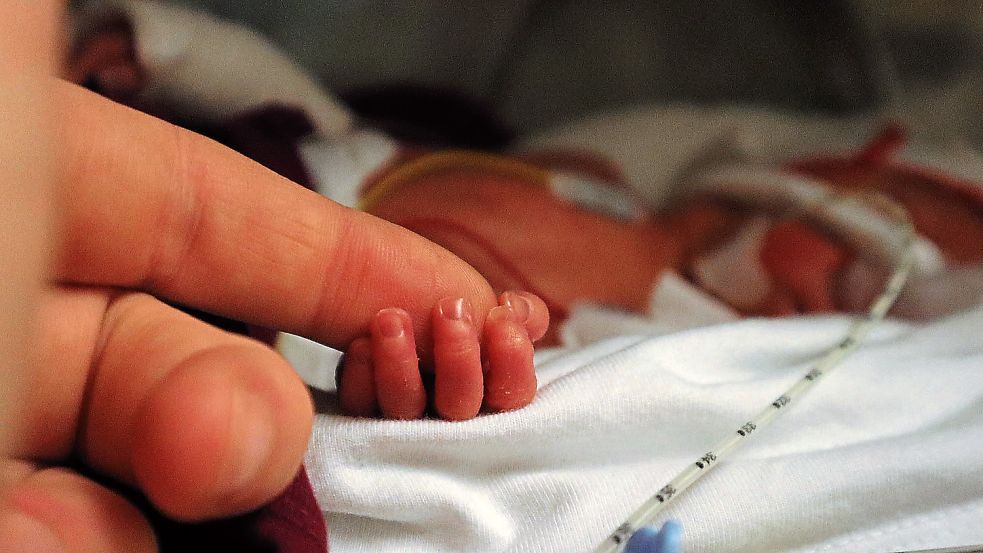 Enya wenige Tage nach der Geburt: Das kleine Mädchen musste im Sommer bereits in der 28. Woche auf die Welt geholt werden, weil es kaum noch Herzschlag hatte. Foto: Privat