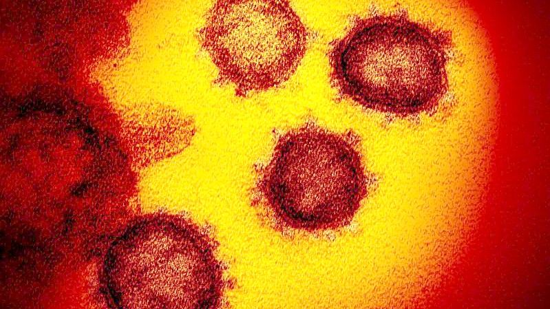 Die vom National Institute of Allergy and Infectious Diseases zur Verfügung gestellte Elektronenmikroskopaufnahme zeigt das Coronavirus SARS-CoV-2, das von einem Patienten in den USA isoliert wurde und aus der Oberfläche von im Labor kultivierten Zellen austritt. Foto: Niaid-Rml/ZUMA Wire/dpa