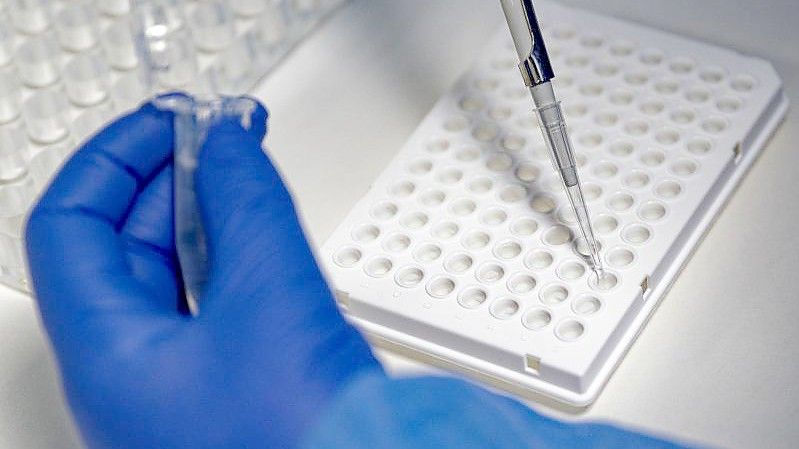 Eine Mitarbeiterin des Labors CBT in Bonn füllt zur Vorbereitung von PCR-Tests eine Testflüssigkeit in eine Trägerplatte. Foto: Henning Kaiser/dpa