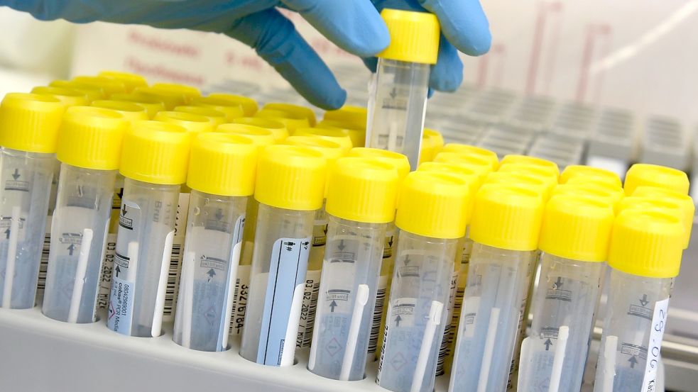 Eine medizinisch-technische Laborassistentin bereitet in einem PCR-Labor die Auswertung von Corona-Tests vor. Foto: Waltraud Grubitzsch/dpa-Zentralbild/dpa