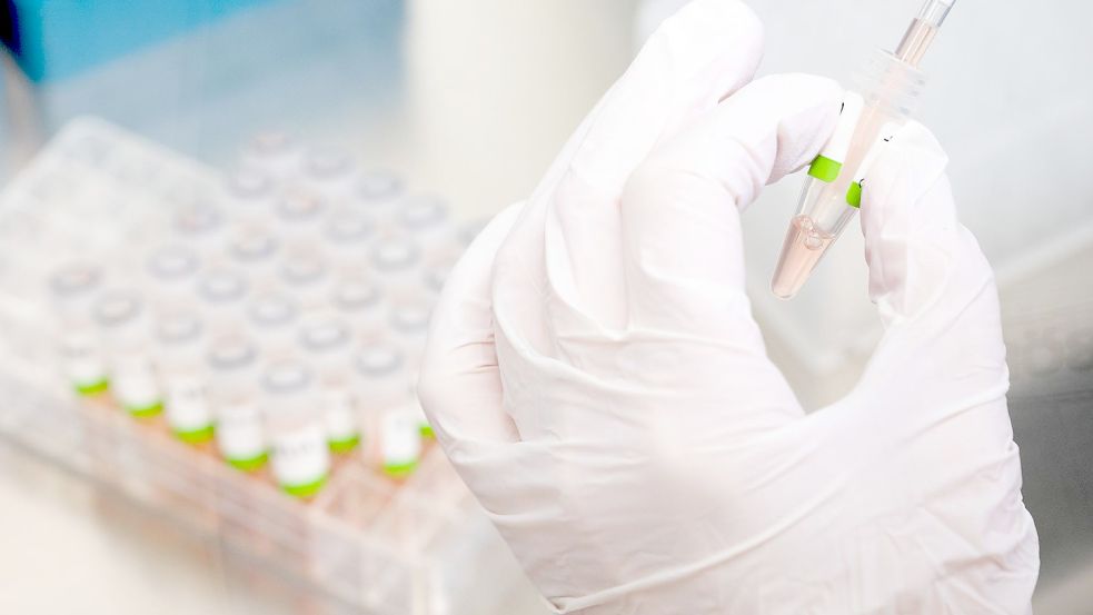 Eine biologisch-technische Assistentin bereitet PCR-Tests auf das Coronavirus im Niedersächsischen Landesgesundheitsamt für die Analyse vor. Foto: Julian Stratenschulte/dpa