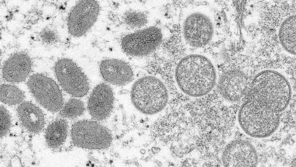 Reife, ovale Affenpockenviren (l) und kugelförmige unreife Virionen (r) aus einer menschlichen Hautprobe: Fälle der eigentlich seltenen Affenpocken werden mittlerweile in immer mehr Ländern nachgewiesen . Foto: Cynthia S. Goldsmith/Russell Regner/CDC/AP/dpa
