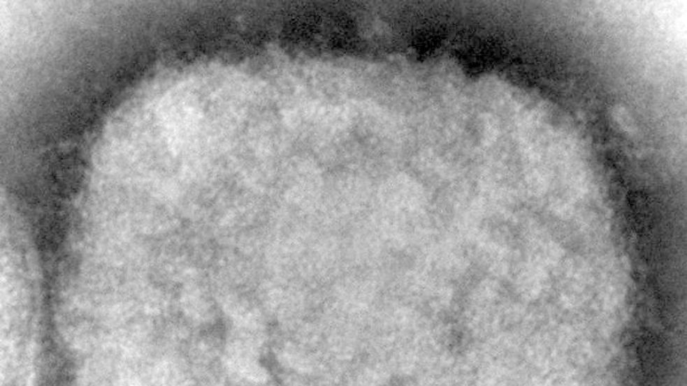 Diese elektronenmikroskopische Aufnahme zeigt ein Affenpockenvirus. Foto: Cynthia S. Goldsmith/CDC via AP/dpa