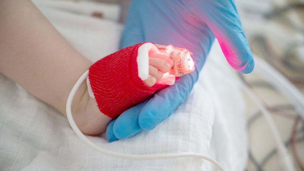 Das RS-Virus ist für Kleinkinder gefährlicher als Corona. Was tun gegen die Überlastung der Kliniken? Foto: Marijan Murat / dpa