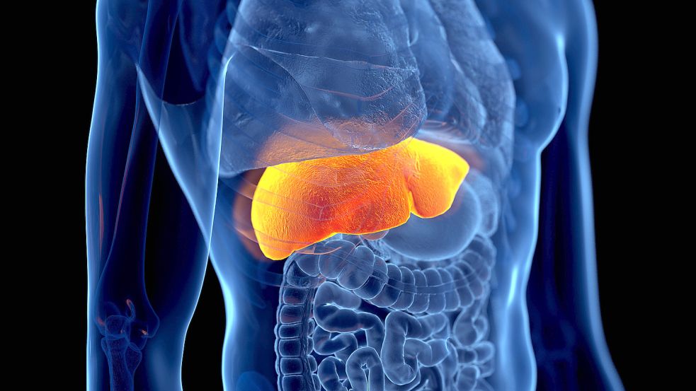Rund ein Drittel der Erwachsenen hat eine Fettleber. Foto: IMAGO IMAGES/Science Photo Library