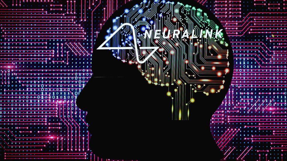 Neuralink will eine Schnittstelle zwischen Gehirn und Computer anbieten. Foto: Imago Images / xJonathanxRaax