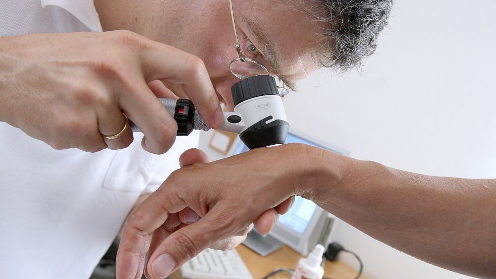 Ein Hautarzt untersucht in seiner Praxis mit einem Vergrößerungsglas die Haut einer Patientin bei einer Hautkrebs-Früherkennung. Symbolfoto: Karl-Josef Hildenbrand/dpa