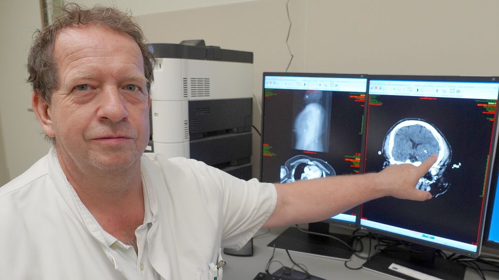 Weniger Knochenbrüche, sondern vielmehr Hirnblutungen machten Kopfverletzungen so gefährlich, sagt Dr. Thomas Klapperich. Er zeigt eine Aufnahme eines Patienten aus dem Computertomografen. Der Radfahrer war frontal gegen ein Straßenschild geprallt – ohne Helm.