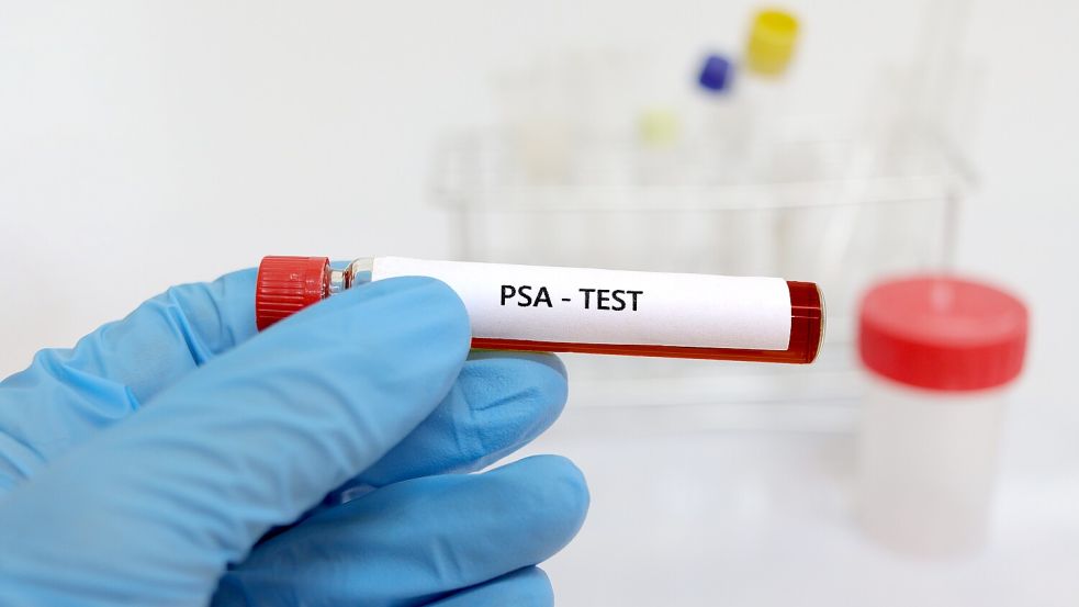 Ab einem Alter von 45 Jahren steht Männern die gesetzliche Früherkennung von Prostatakrebs zu. Experten raten, einen PSA-Test machen lassen. Foto: IMAGO/Pond5 Images