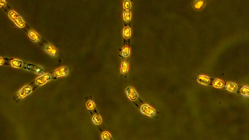 Die Kieselalge Skeletonema marinoi ist nach 7000 Jahren in einem Dauerzustand auf dem Meeresgrund nun wieder aktiv. Foto: S. Bolius/Iow/dpa