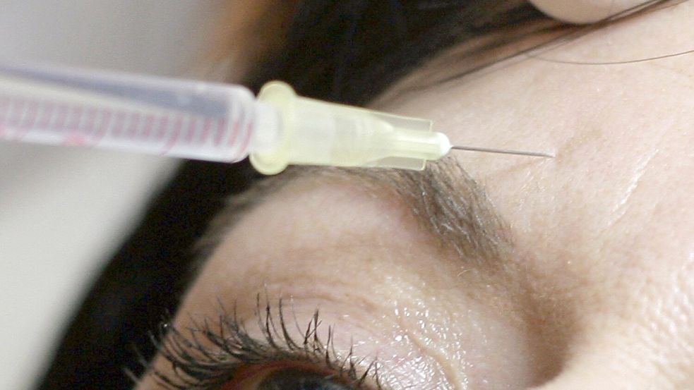 Am BGH geht es um sogenannte minimalinvasive Schönheitsbehandlungen. (Symbolbild) Foto: Peer Grimm/dpa-Zentralbild/dpa