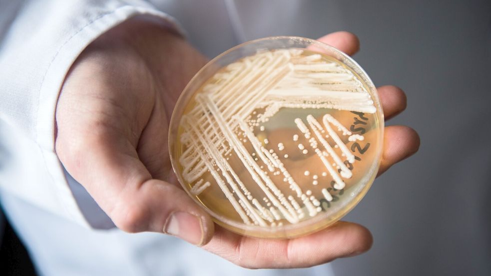 Eine Petrischale mit dem Hefepilz Candida auris. Foto: Nicolas Armer/dpa