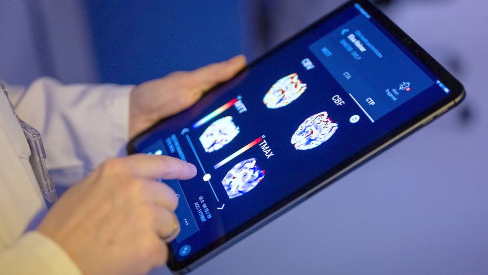 Gehirnbilder eines Patienten in einer KI-basierten App. Nach einer Deloitte-Umfrage sehen viele Bürgerinnen und Bürger den Einsatz von KI in der Medizin skeptisch, vor allem wenn es um die Therapie geht. (Symbolbild) Foto: Monika Skolimowska