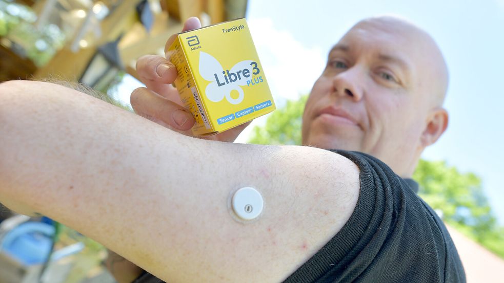 Marco Kampen aus Firrel hat einen Glukose-Sensor am Arm. Dieser übermittelt die Blutzuckerwerte live an das Handy. Foto: Klaus Ortgies/Archiv