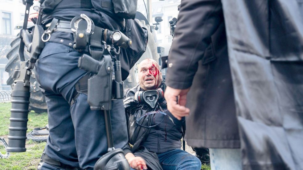 Ein Demonstrant sitzt verletzt auf einem Bordstein. Foto: Marius Burgelman/AP/dpa