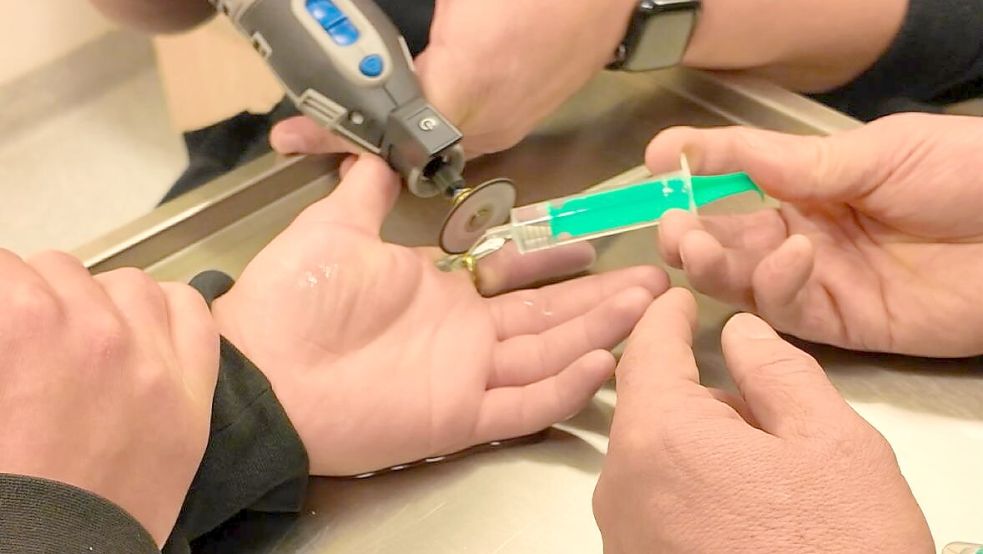 Einsatz der anderen Art: Im Februar haben Kameraden der Feuerwehr Wildeshausen einen Ring vom Finger eines Mannes gefräst. Foto: Pressestelle Feuerwehr Wildeshausen