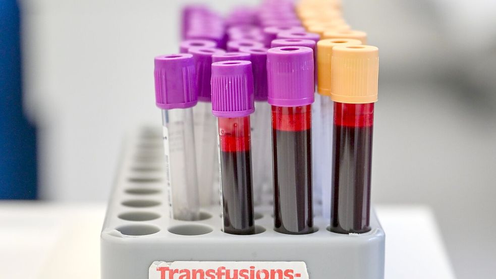 Eine Blutspende kann bis zu drei Menschen helfe (Symbolbild). Foto: Jens Kalaene
