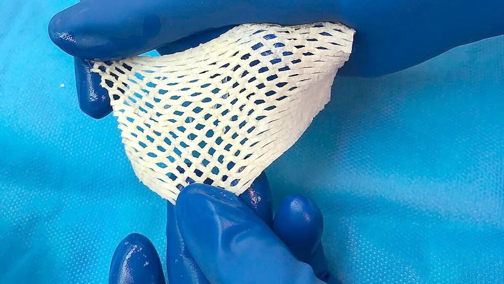 Wichtige Alternative für Hautttansplantationen: Fischhaut. Foto: Saziye Karaca/-/dpa