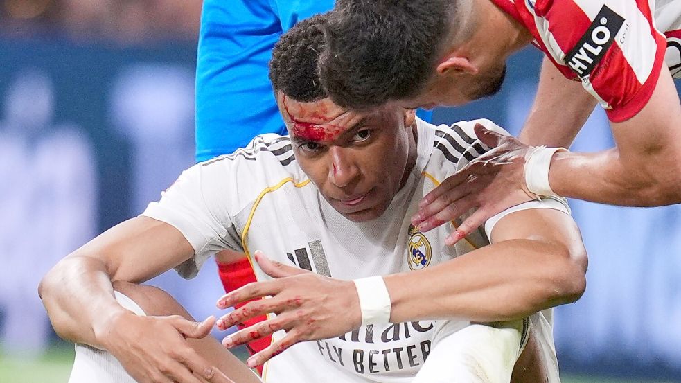 Kopfwunde bei Reals Generalpobe: Aber Kylian Mbappé kann in München wohl auflaufen. (Archivbild) Foto: Manu Fernandez