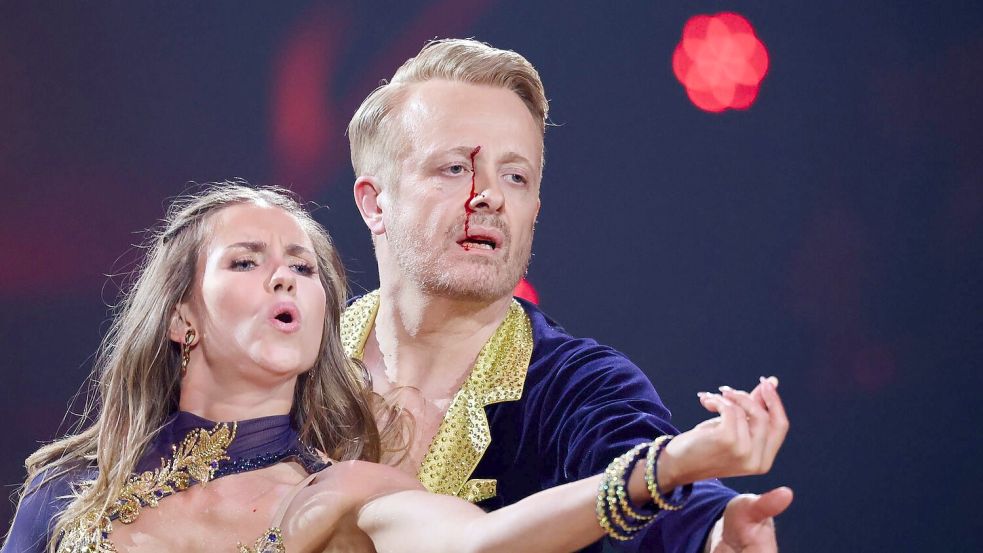 Ross Antony ist eine Runde weiter - obwohl ihm nach einem kleinen Unfall Blut über das Gesicht lief. Foto: Rolf Vennenbernd