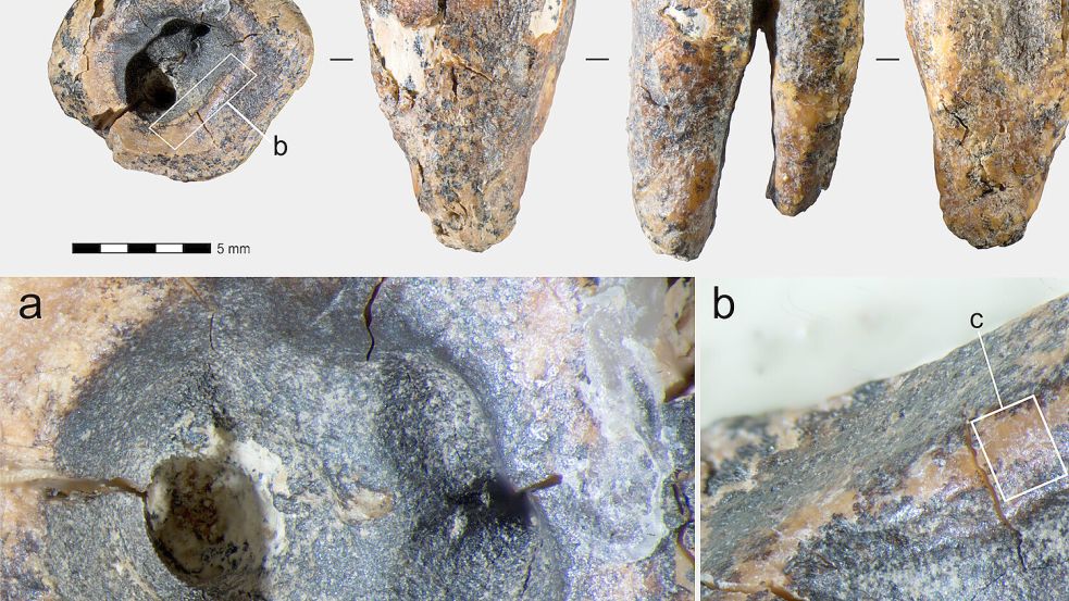 Prähistorische Zahnbehandlung: Der Backenzahn weist Kratz- und Bohrspuren auf. Foto: Zubova et al., PloS One / 2026 / CC