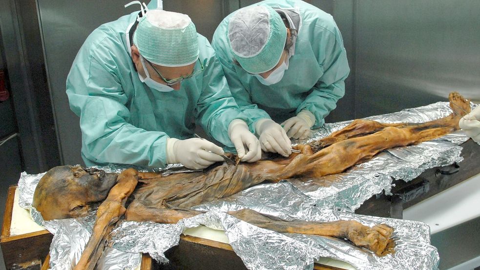 Ötzi wurde hundertfach untersucht Foto: M.Samadelli/Southtyrolarchaeolog
