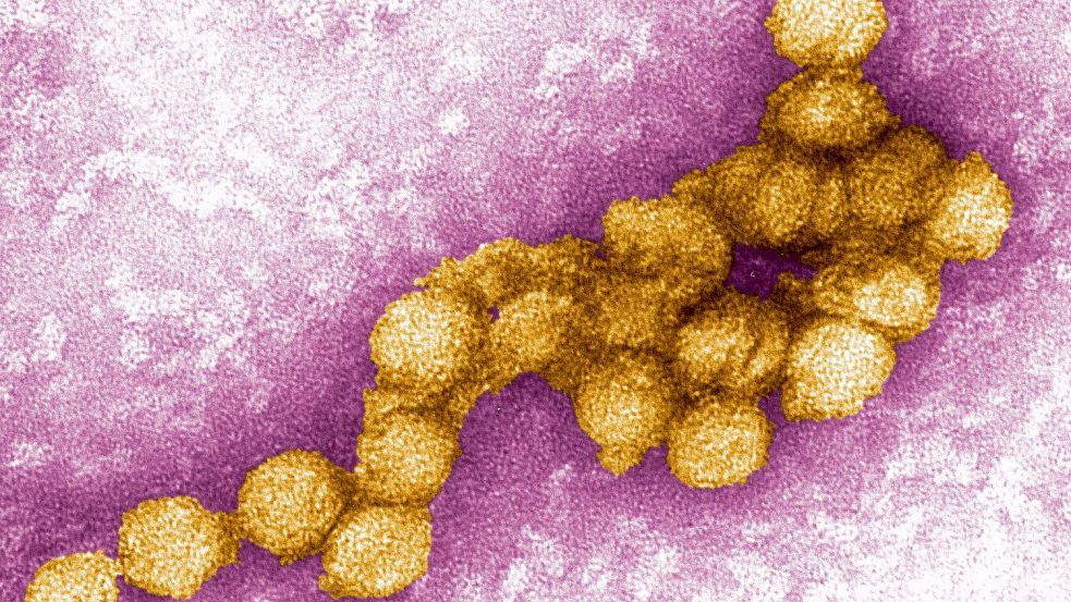 Das West-Nil-Virus unter dem Elektronenmikroskop. (Archivbild) Foto: Cynthia Goldsmith/CENTERS FOR DISEASE CONTROL/EPA/dpa