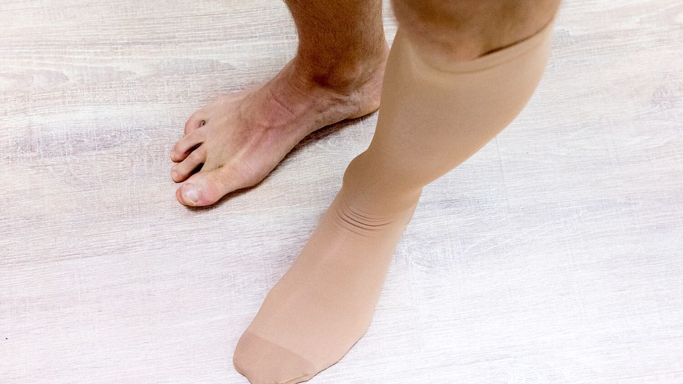 Berlin: Thrombose: Wieso sie so gefährlich ist und wie man sie erkennt